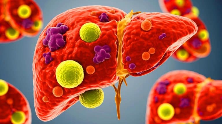 Scientists Expose Terrifying Liver Cell Damage: Is This The Hidden Health Crisis Threatening Millions In 2023?